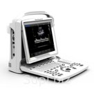Узи сканер SONOTOUCH 60 CHISON