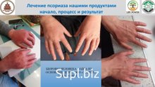 ЗДОРОВЬЕ ЧЕЛОВЕКА – ОДНА ИЗ ОСНОВНЫХ ЦЕЛЕЙ  ООО «ЭНЕРГИЯ»  " LIFE POWER " 

Крема для тела/рук/ног, скрабы, бальзамы, экстракты, настои  и т.д.  

Спортивные в…