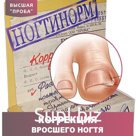 Ногтинорм